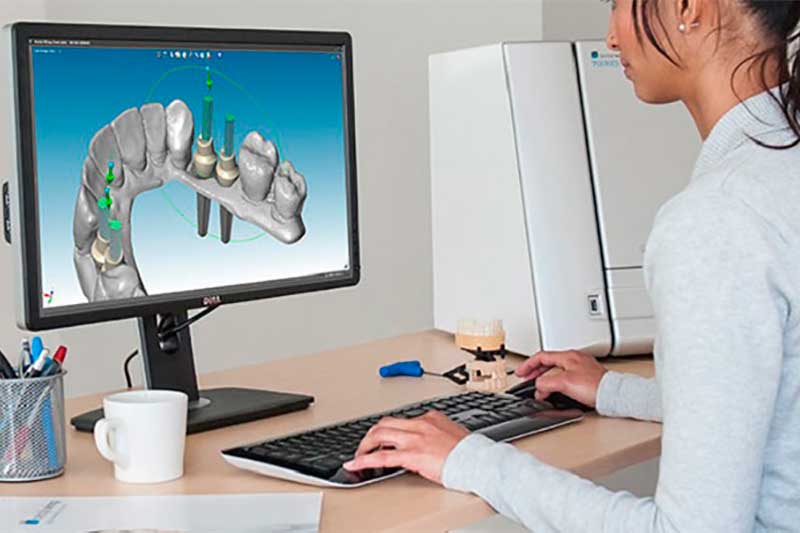Tecnología CAD-CAM dental en Clínica Dental Vallecas