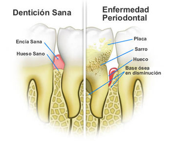 periodoncia4.jpg