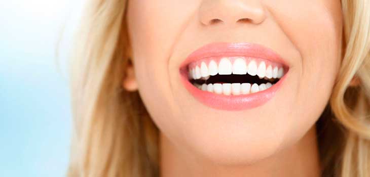 Programa Express para estética dental en Clínica Dental Vallecas