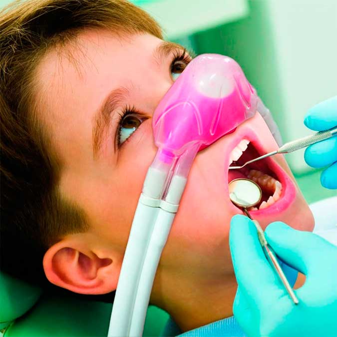 Sedación consciente en niños en Clínica Dental Vallecas