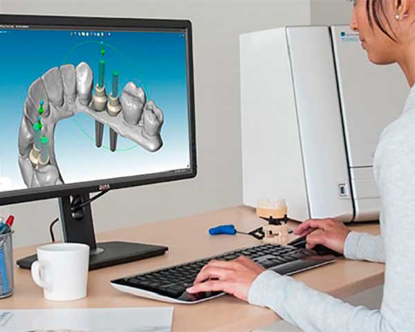 Tecnología CAD-CAM en Clínica Dental Vallecas