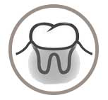 Tratamiento de la periodoncia en Clínica Dental Vallecas