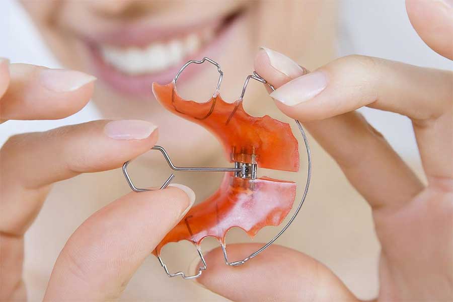 Los ortodoncistas de Clínica Dental Vallecas te informan sobre el uso de los retenedores bucales