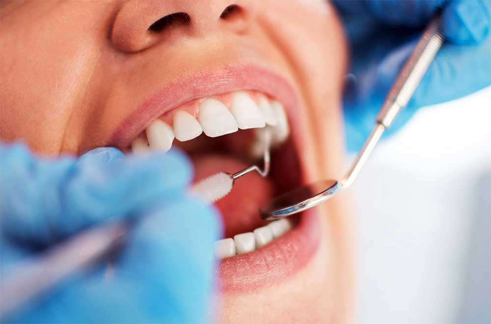 Clínica Dental Vallecas: Curetajes: qué son, cómo se realizan, cuándo son necesarios